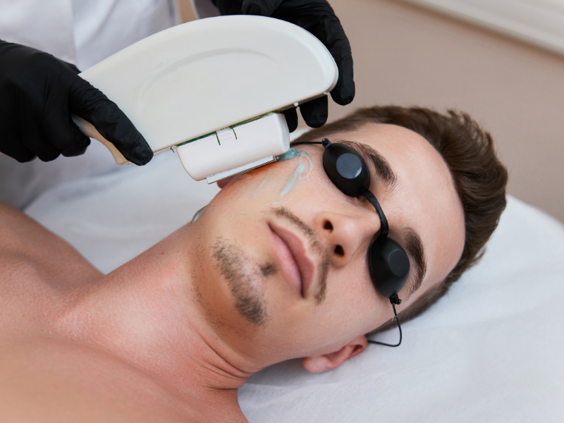 Depilação a Laser
